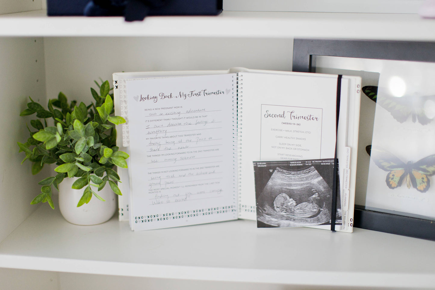 Pregnancy Journal, Black White & Gold