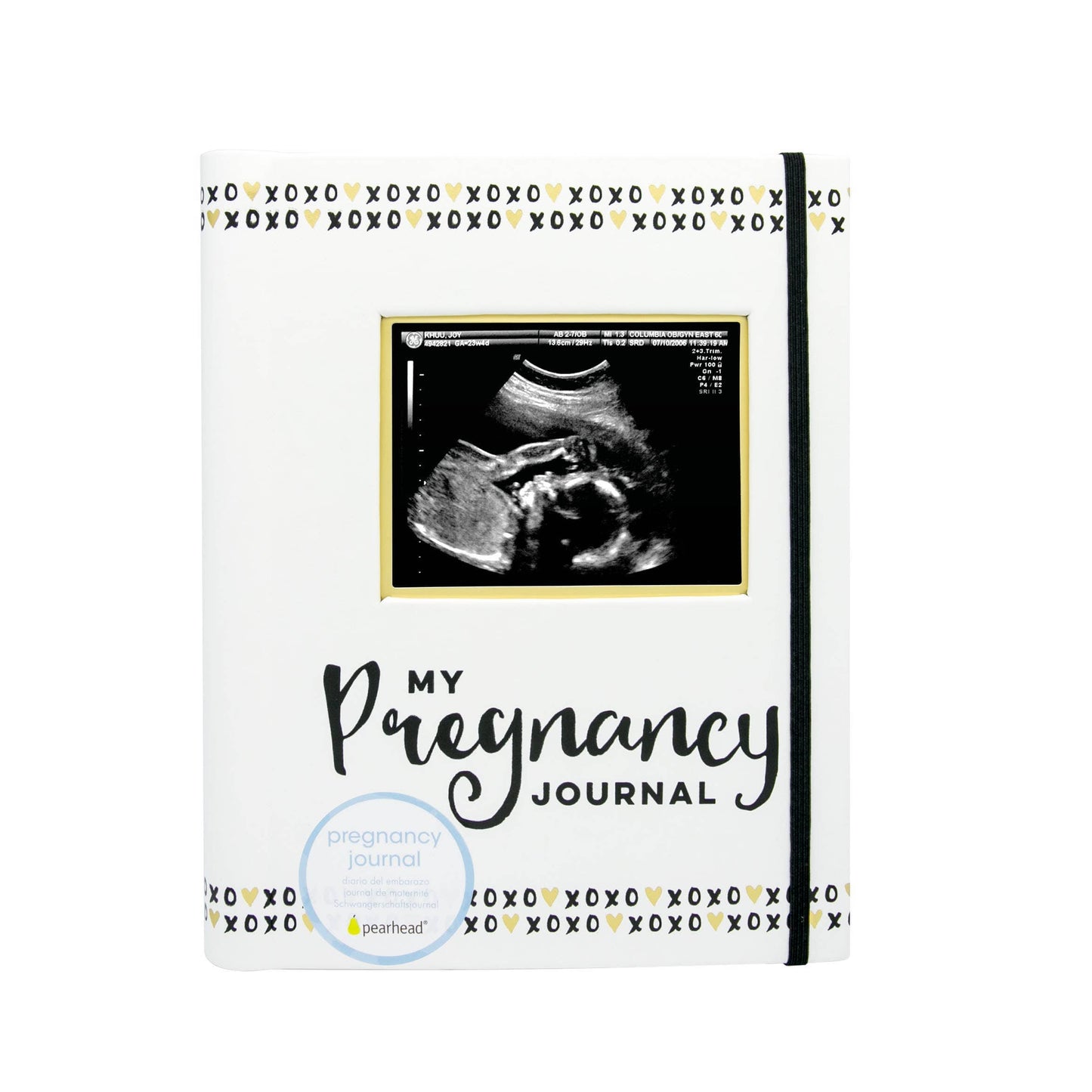 Pregnancy Journal, Black White & Gold